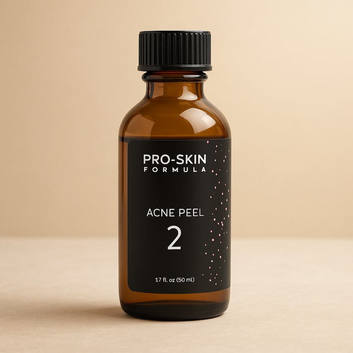 For non - USA clients only: Chemical peel 2