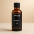 For non - USA clients only: Chemical peel 3
